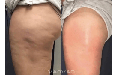 MamaSculpt Massager in sleek white design