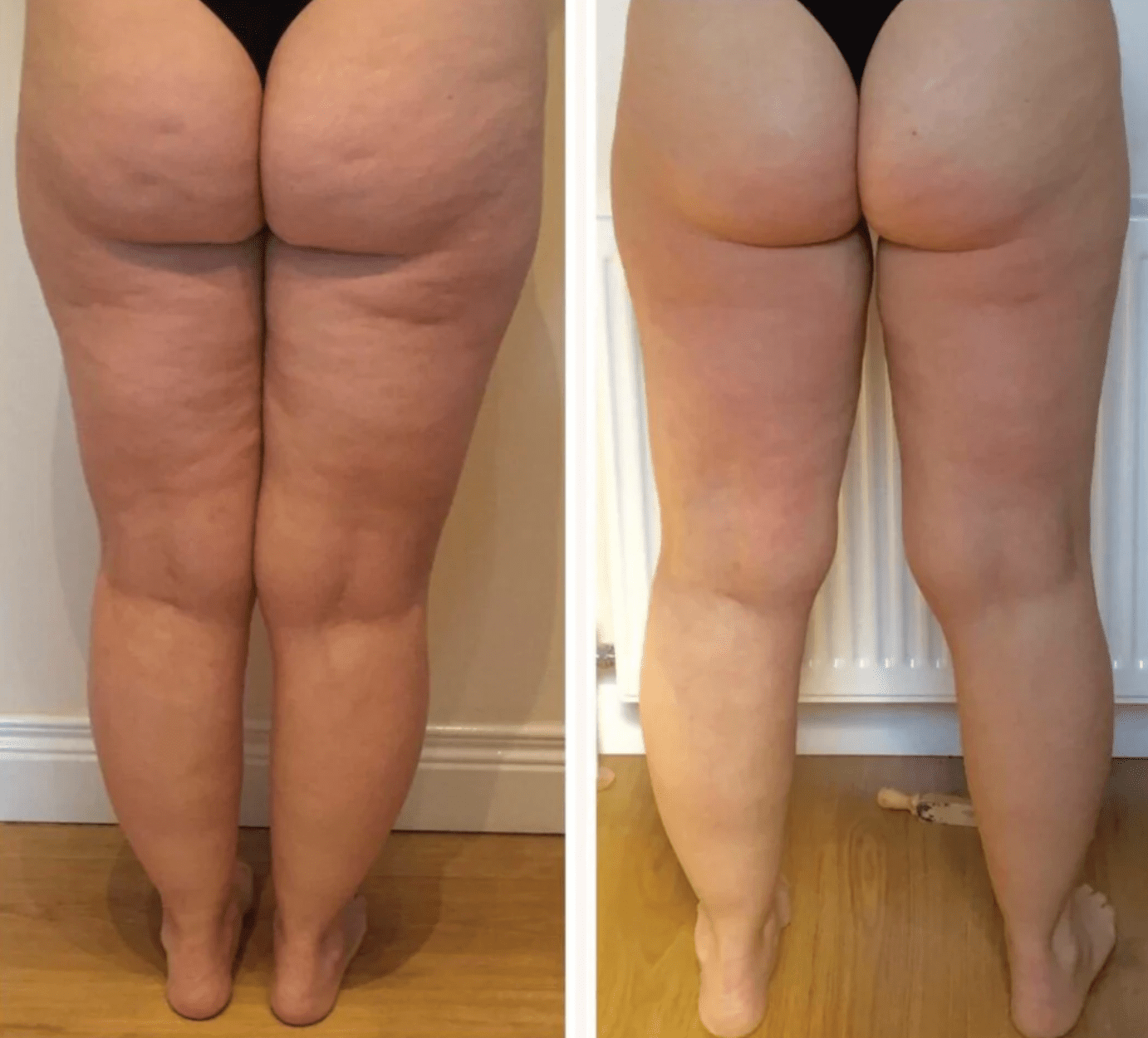 Woman using MamaSculpt Massager at home