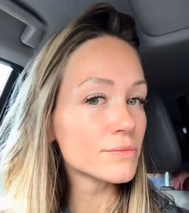 Skin with improved clarity and reduced redness after using Heartleaf products