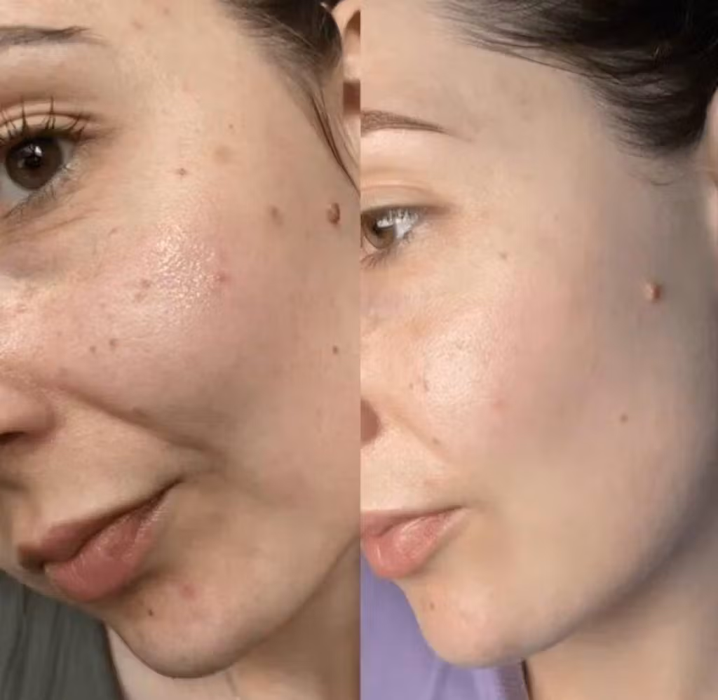 Jessica L. applying the Anua Heartleaf Lotion