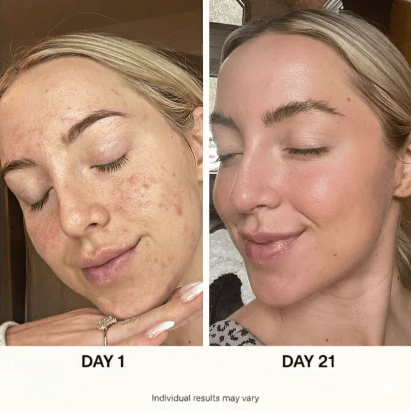 Customer smiling with clear, hydrated skin after using Anua products