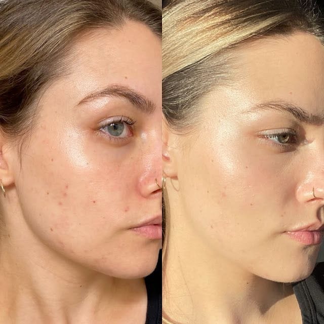 Satisfied customer holding Anua skincare products