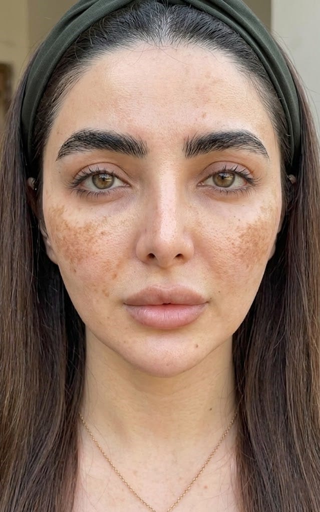 صورة قبل الاستخدام للمنتج
