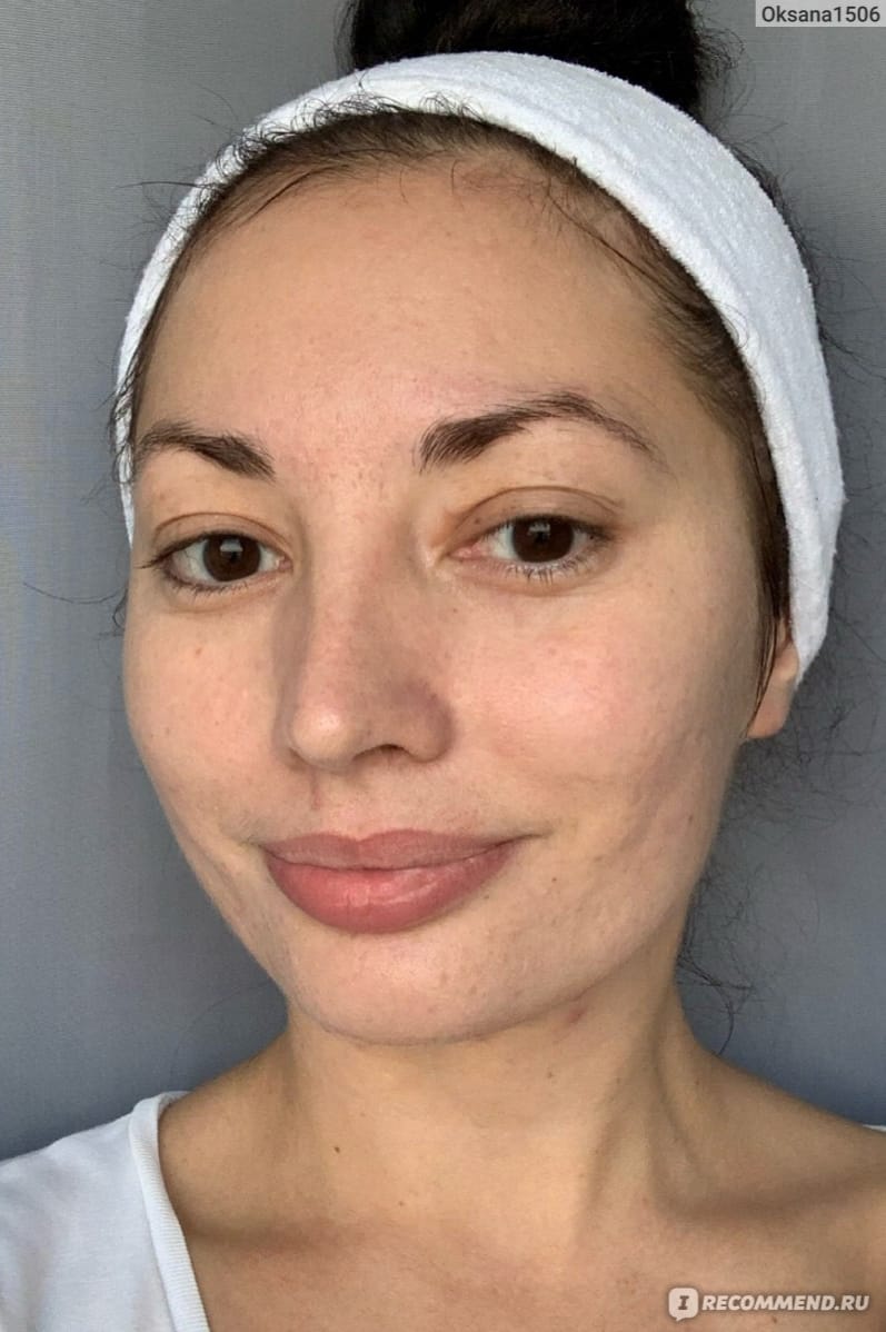Radiant skin after using Centella Travel Kit