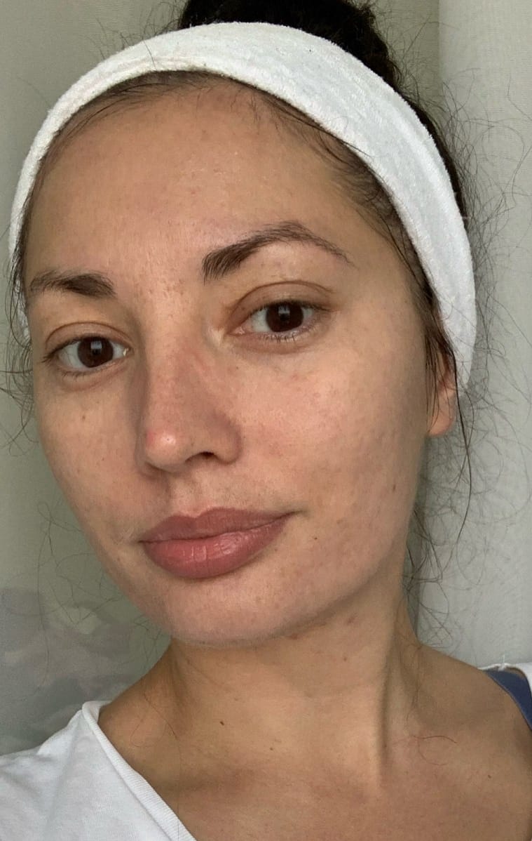 Sensitive skin before using Centella Travel Kit