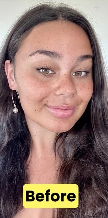 Before using Tannies, skin lacks radiance