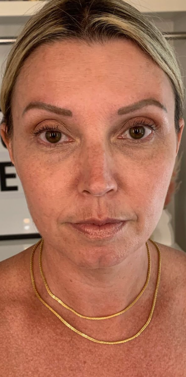 Dry skin before using Dynasty Cream