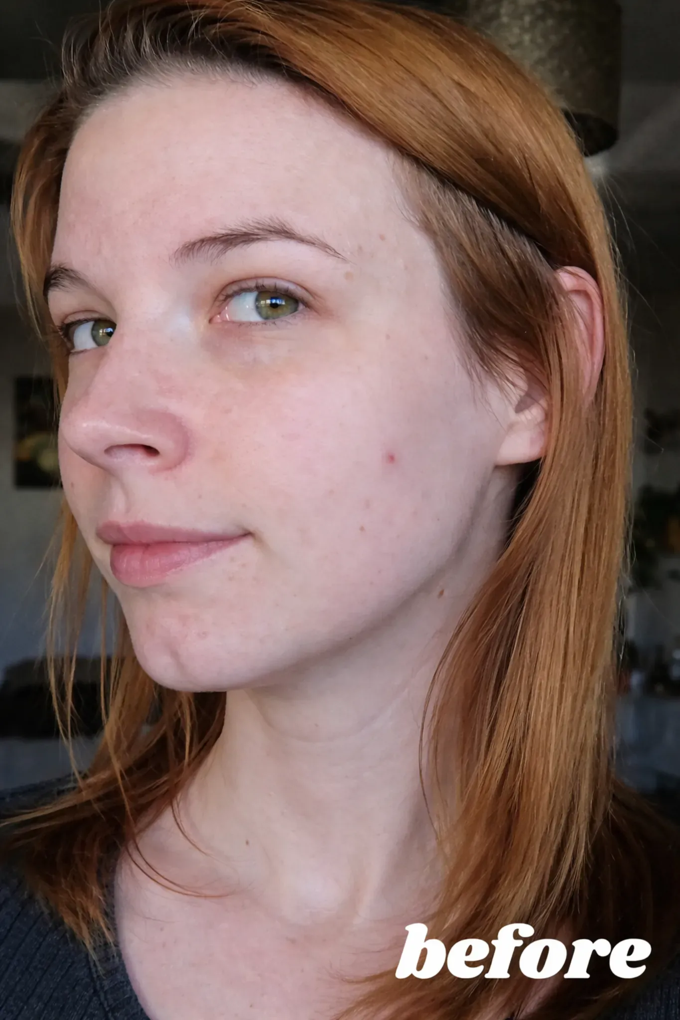 Initial skin condition before using Glowvyn