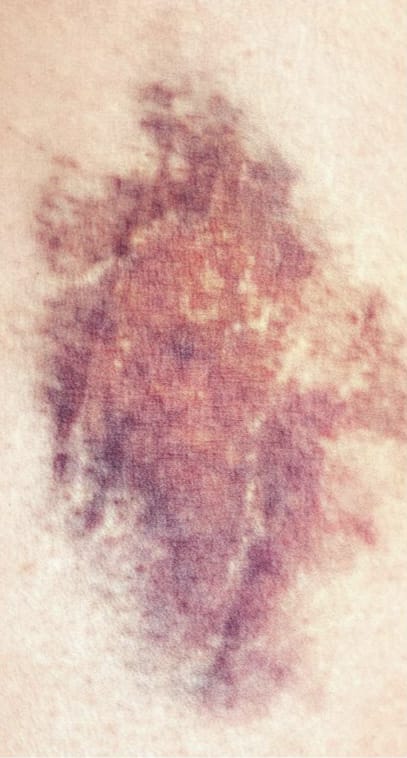 Mancanza di freschezza e benessere