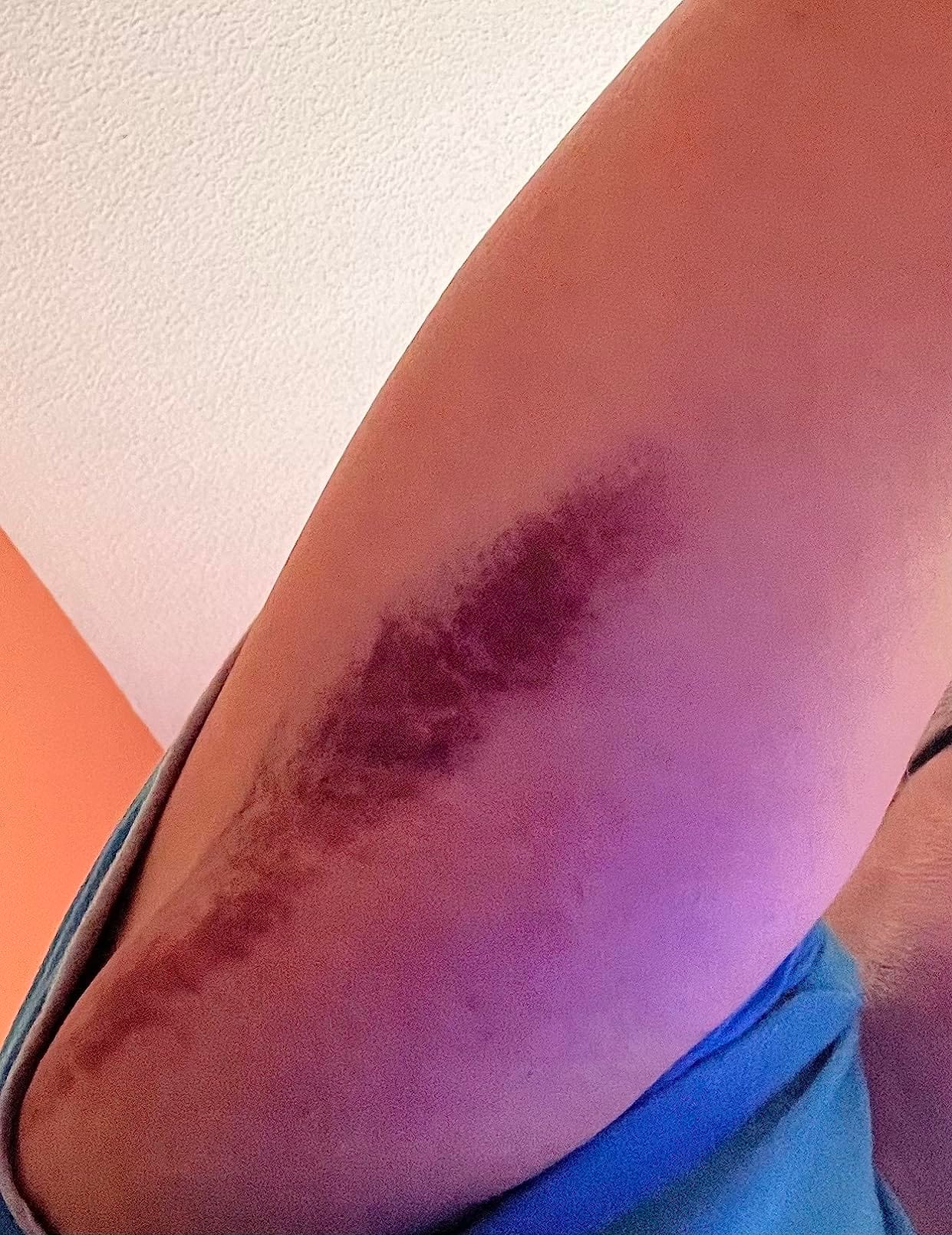 Cliente che applica ProductX sulla pelle