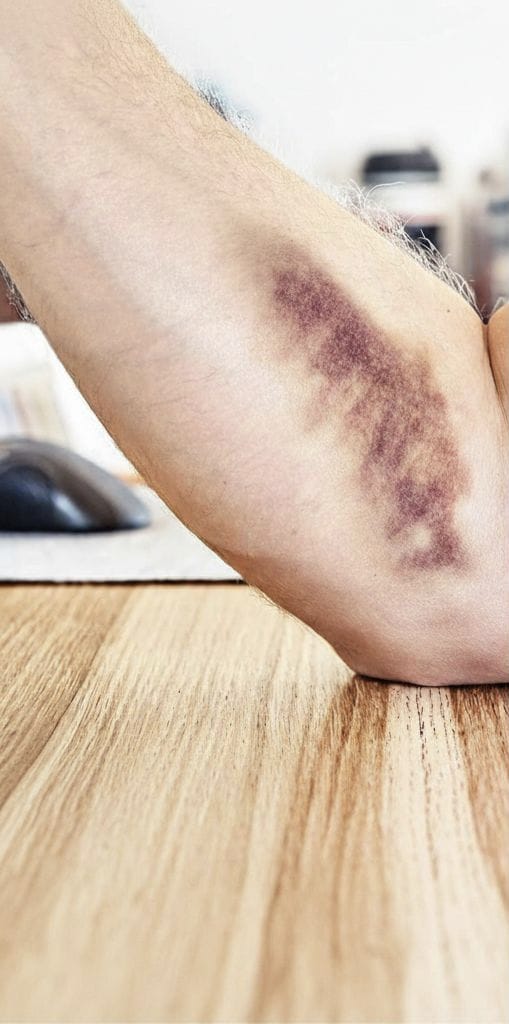 Tensione muscolare presente