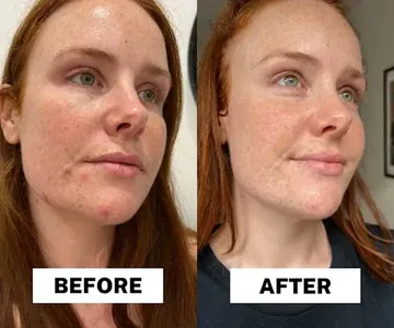 Customer applying Dr. Melaxin Multi Balm for hydration