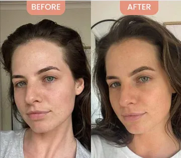 Close-up of even skin tone after using Dr. Melaxin Collagen Boost Set