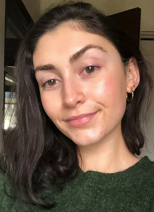 Skin before using Dr. Melaxin Collagen Boost Set