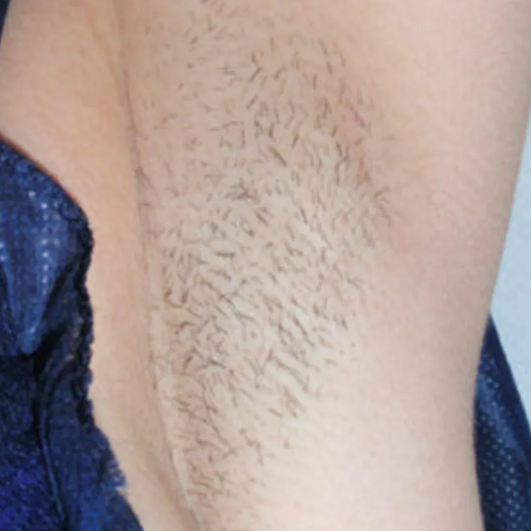 woman with smooth skin