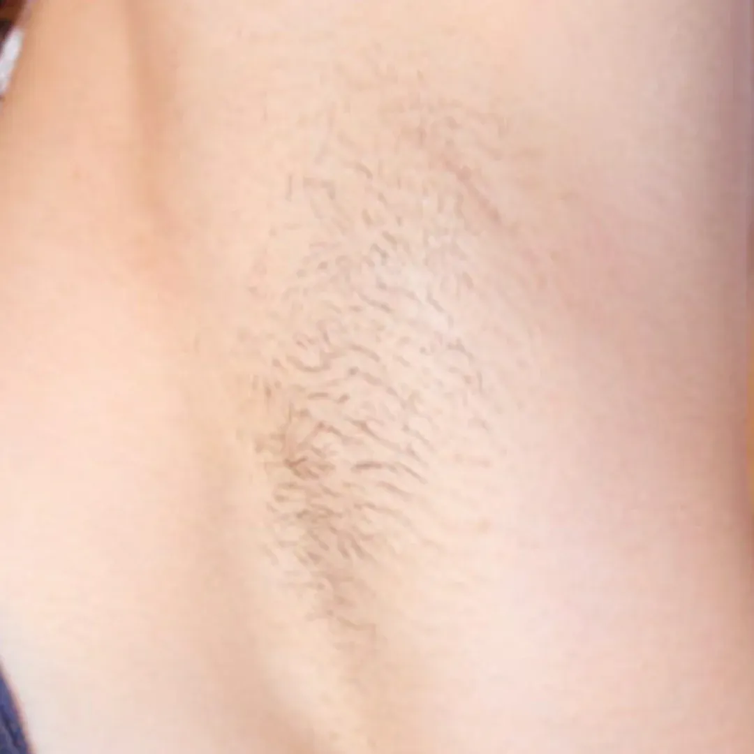 hair growth reduction oil bottle