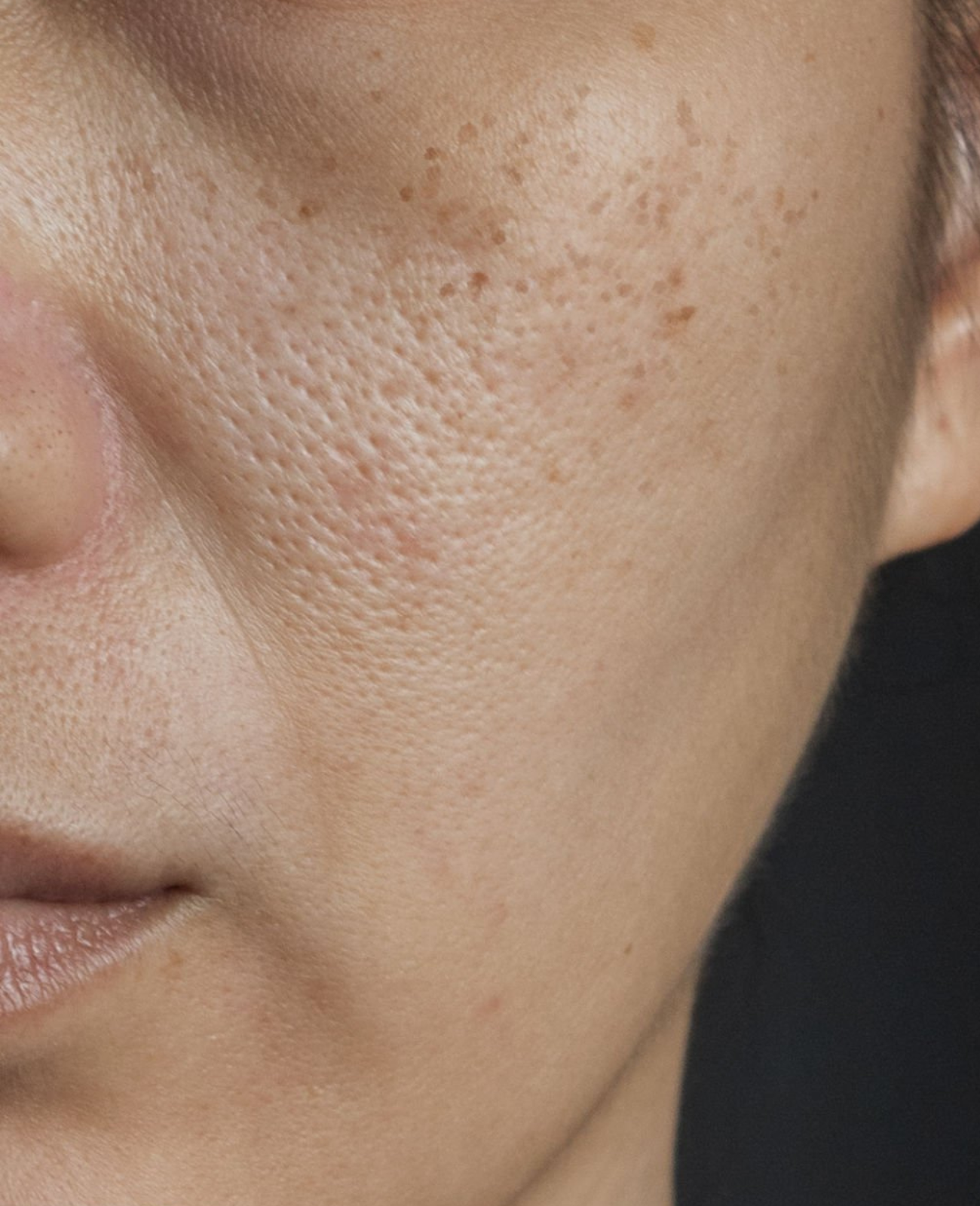 Dry and lackluster skin before treatment with the Dr. Melaxin set.