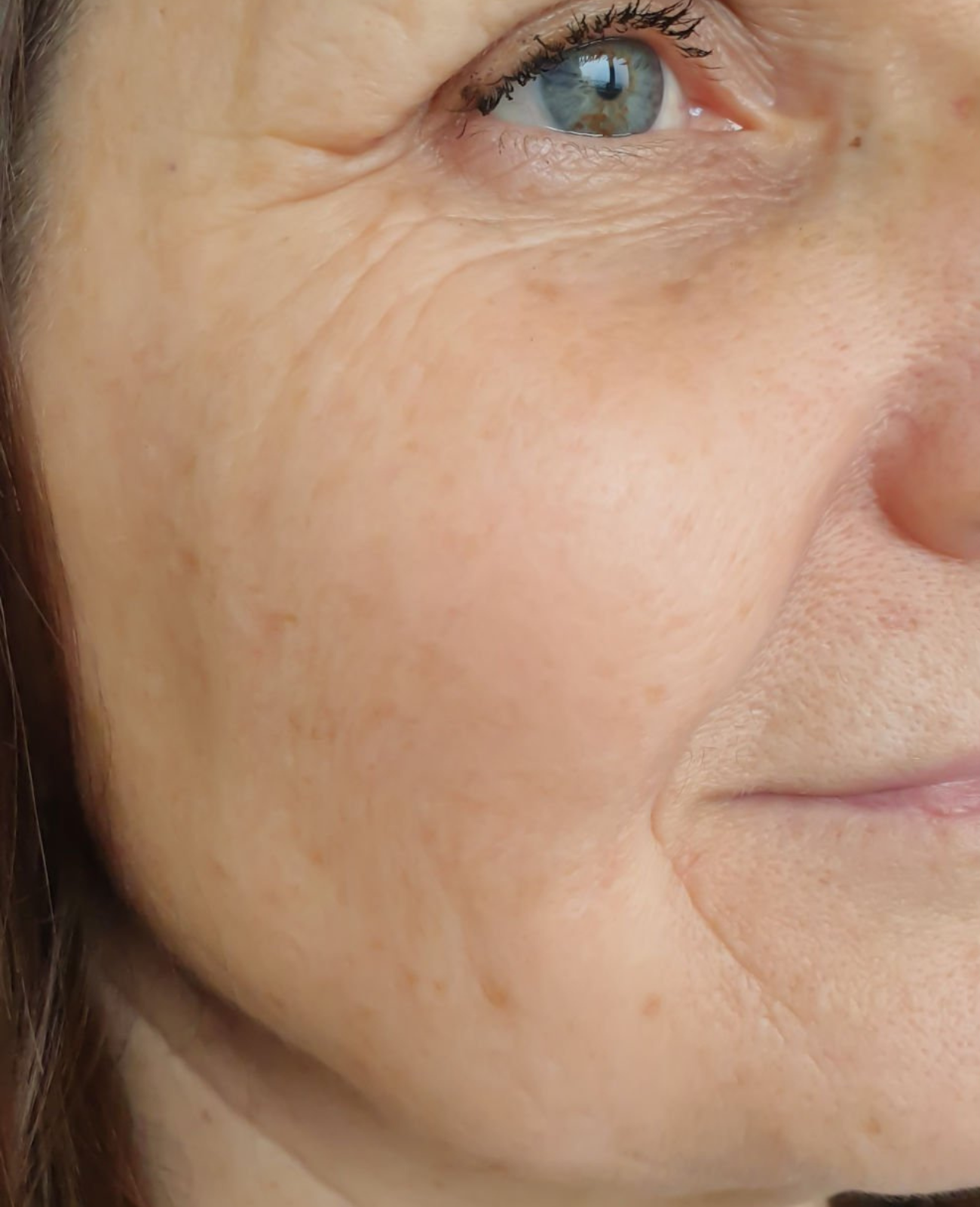 Initial skin condition before using the Dr. Melaxin Radiant Blowout Routine Set.