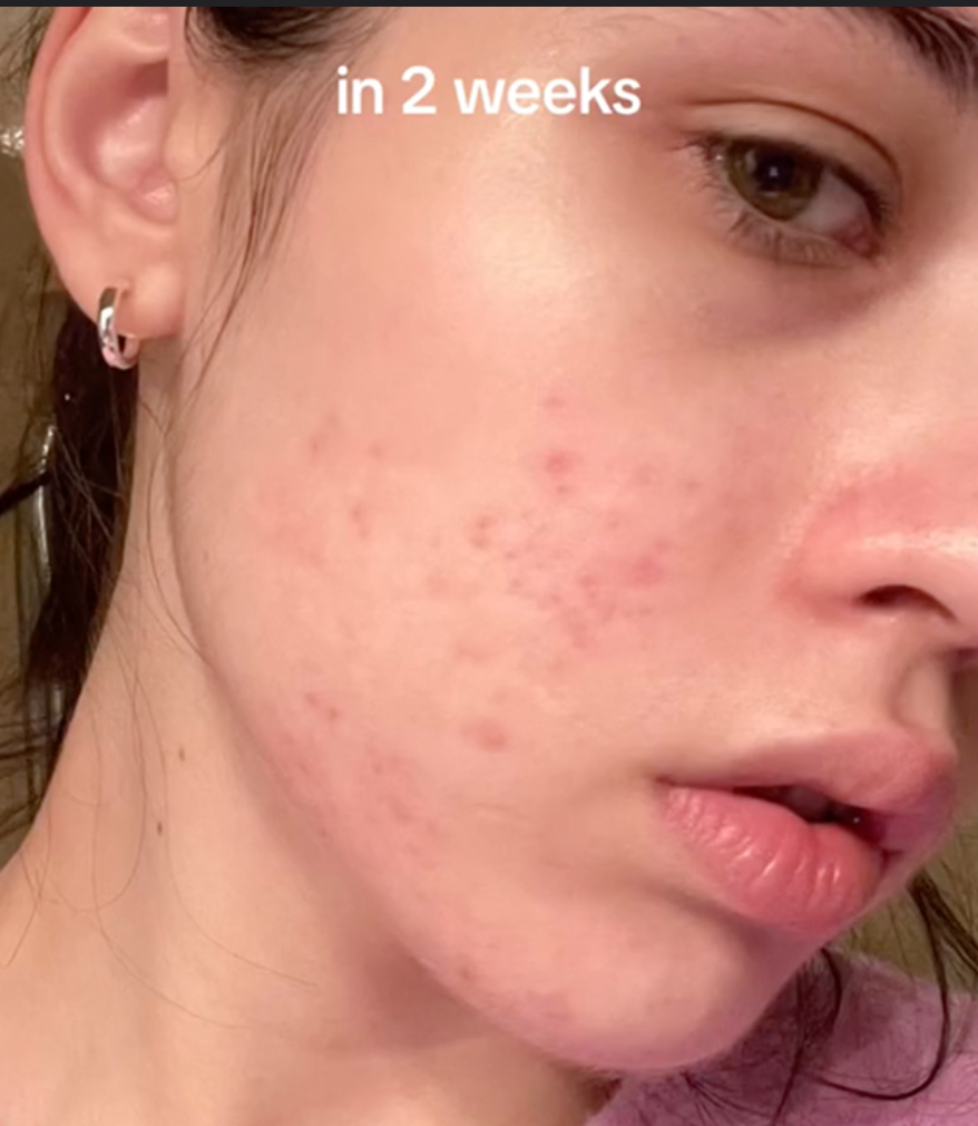 صورة توضح تأثير المرطب في ترطيب البشرة