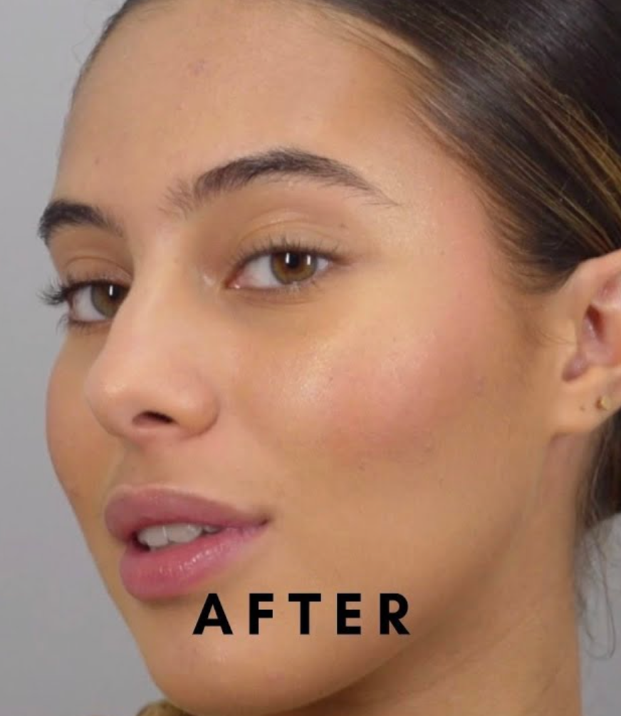 صورة توضح البشرة بعد استخدام مجموعة العناية الكاملة