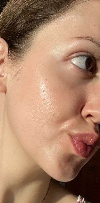 Dull skin before using Vegan Kombucha Skincare