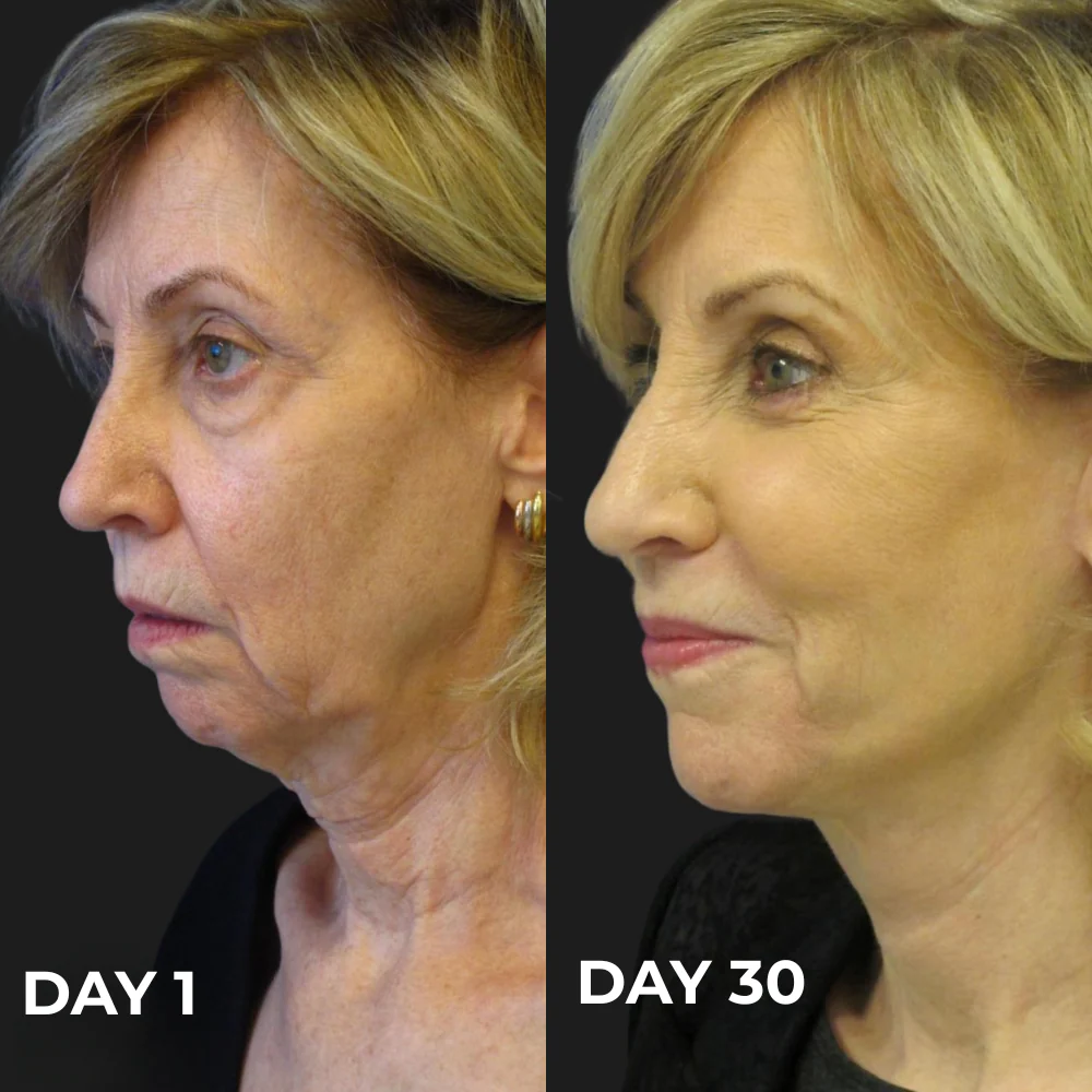 Hand applying Cammora Care Collagen Boost Serum to the neck.