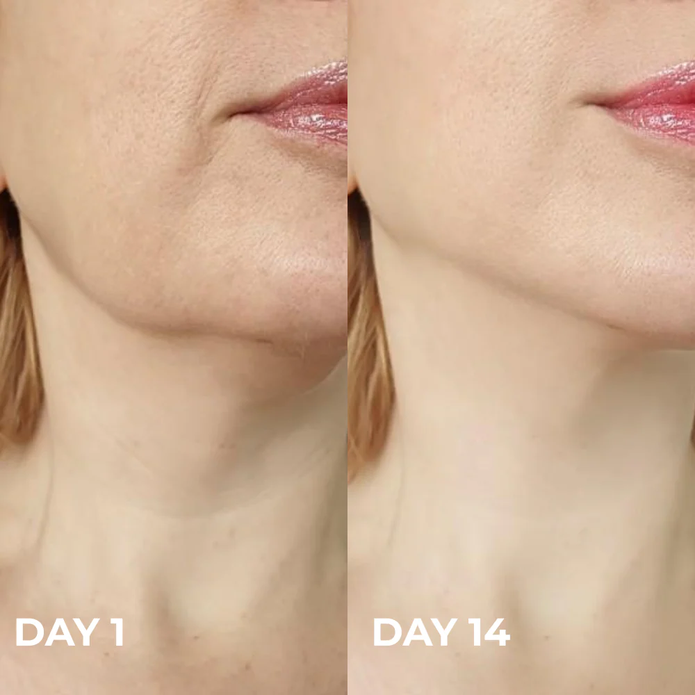 Cammora Care device with EMS and heat modes active on the jawline.