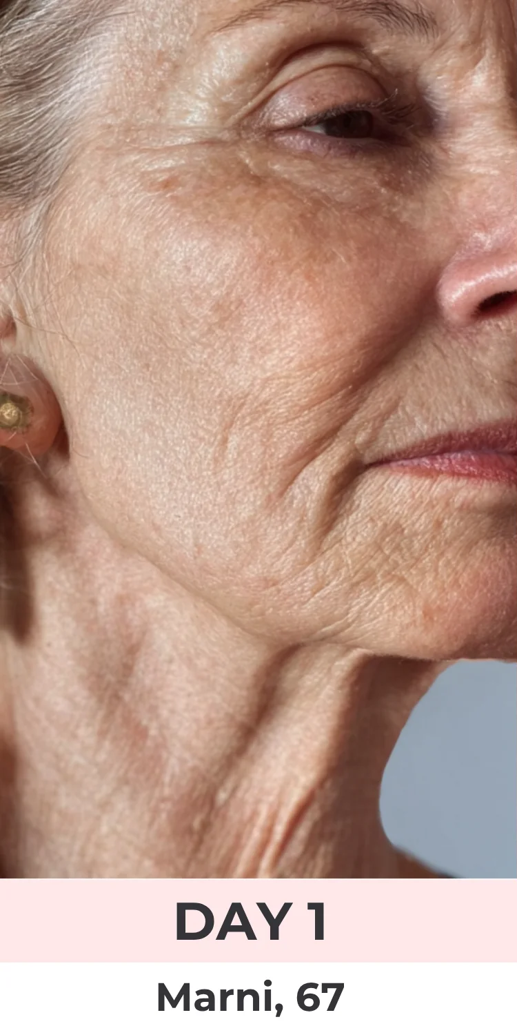 Woman with visible signs of aging on her neck before using the Neck Sculptor