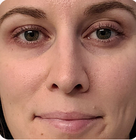 Dull skin before using Medicube Pink Glow Serum Set