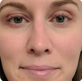 Radiant skin after using Medicube Pink Glow Serum Set