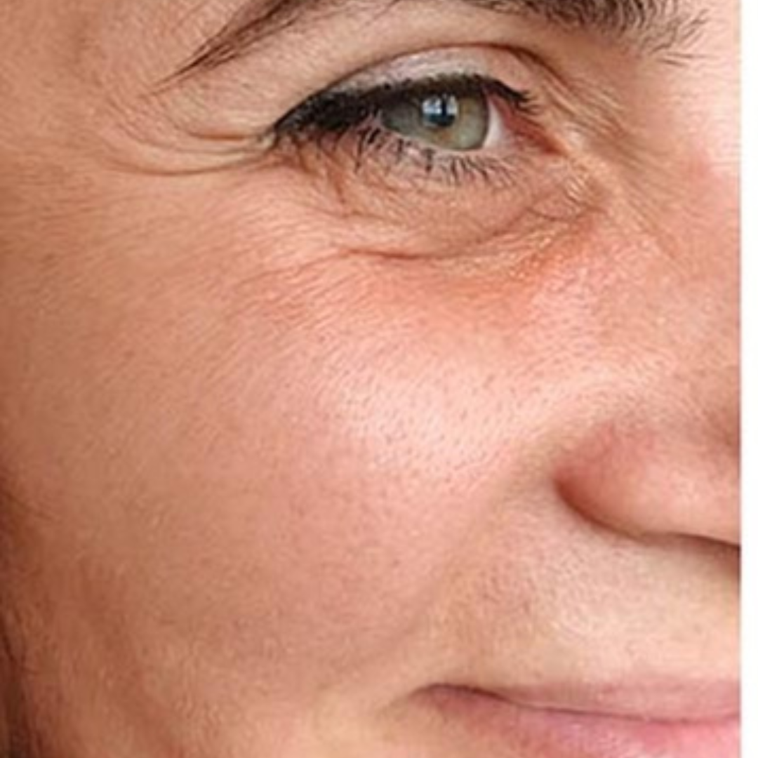 Dry and dull skin before applying Medicube Collagen Jelly Cream
