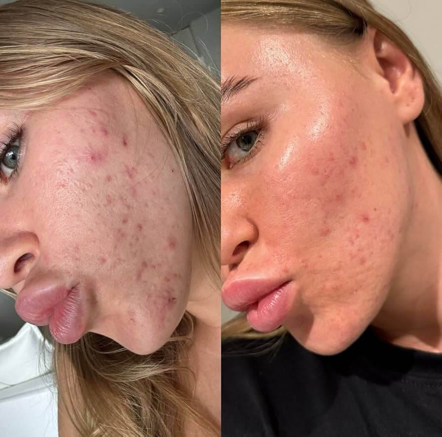 Woman with brighter, even-toned skin