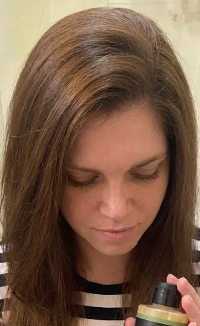 Moisturized scalp after shampoo