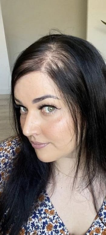 Damaged hair before rosemary shampoo