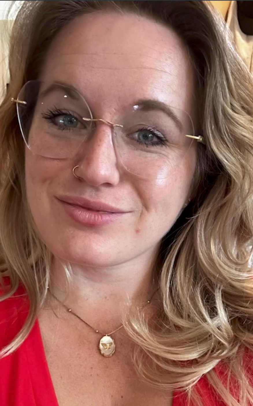 Skin before using the PDRN Pink Collagen Gel Mask showing texture