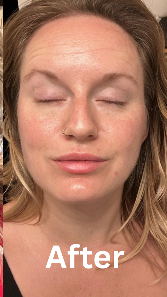 Skin with a glass glow finish after using the PDRN Pink Collagen Gel Mask