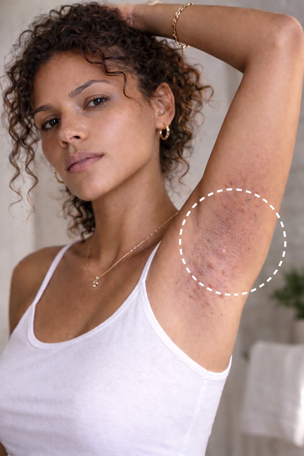 Image showing dull skin before using GlowEssence