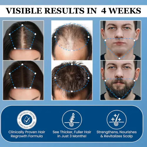 مظهر شعر صحي