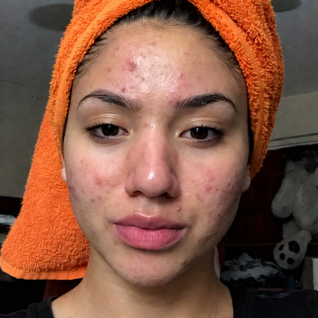 Imagen antes de usar la loción