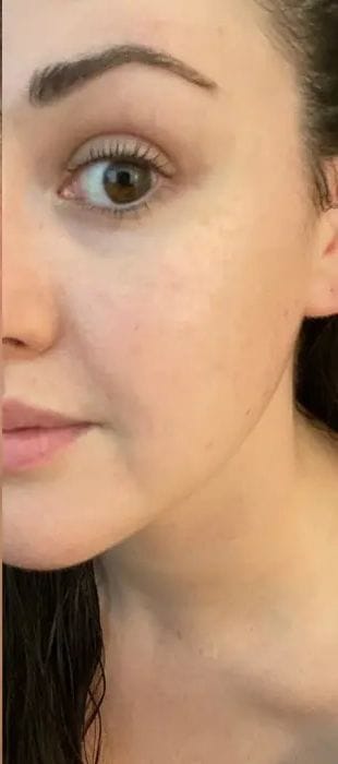 بشرة خالية من العيوب بعد استخدام V-Soin