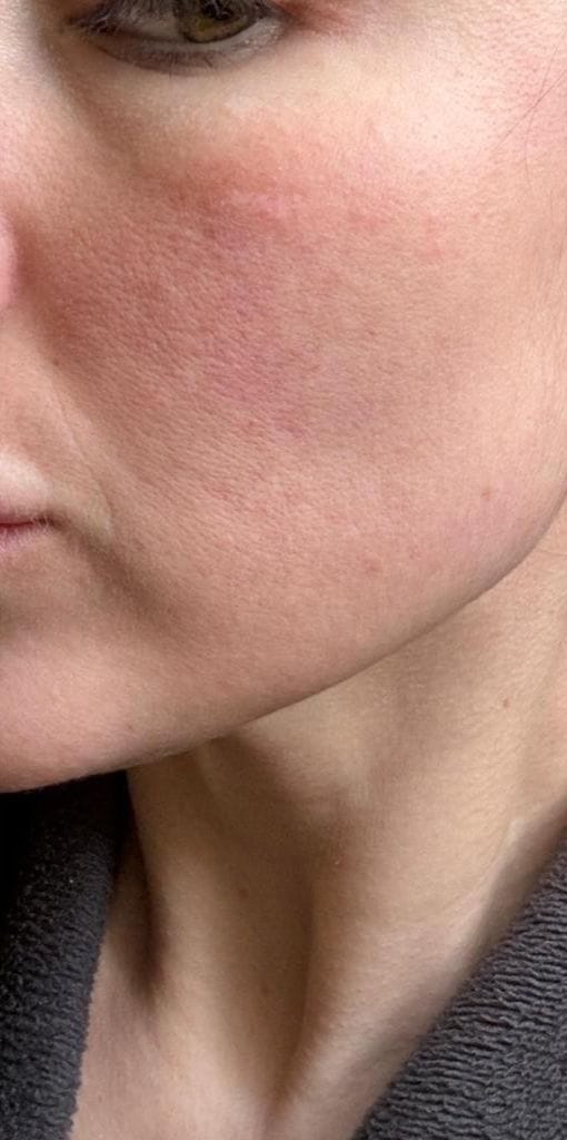 بشرة مشرقة ونضرة بعد استخدام V-Soin