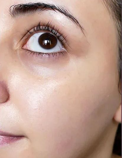 بشرة متألقة بعد استخدام V-Soin