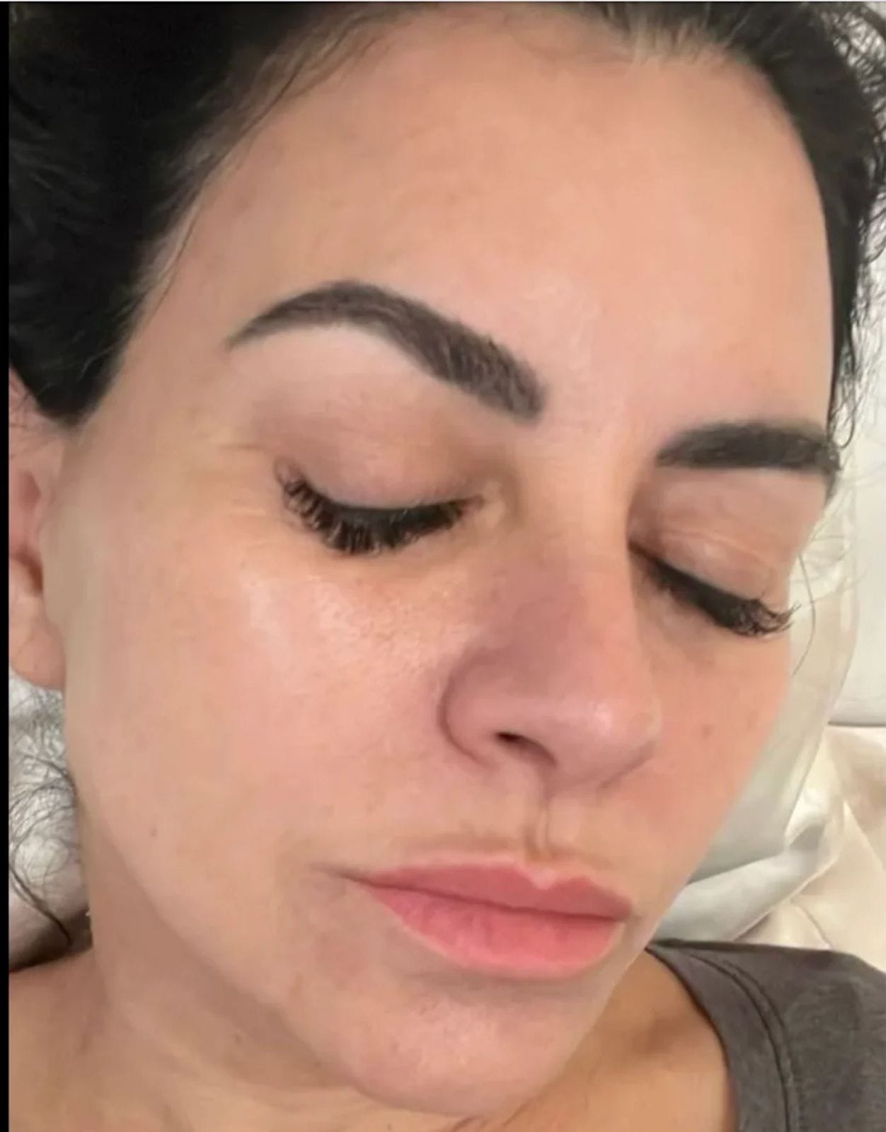 بشرة ناعمة ومشرقة بعد استخدام V-Soin