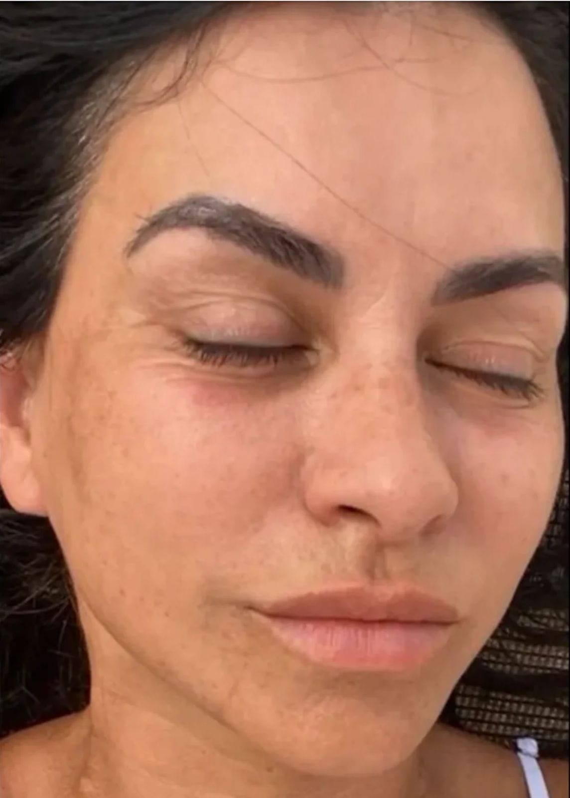 بشرة باهتة قبل استخدام V-Soin