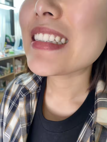 Animated purple wave neutralizing yellow tones on teeth.