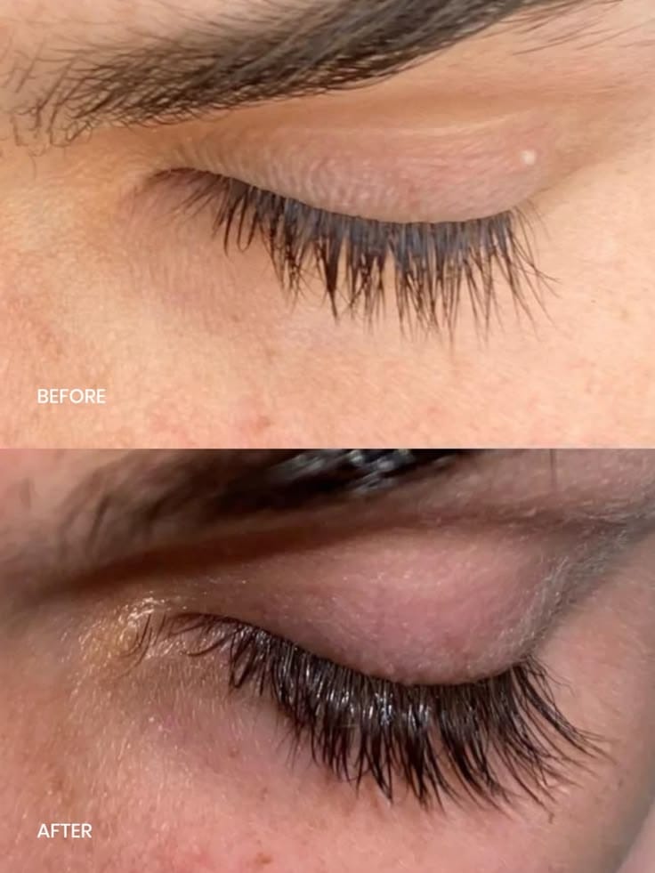 Before and after comparison of lashes using the serum