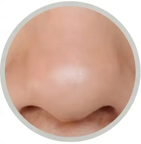 Visuel après utilisation du produit