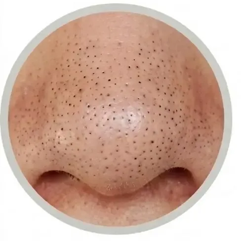 Visuel avant utilisation du produit