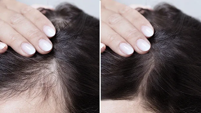 صورة شعر صحي ولامع بعد استخدام زبدة الباتانا