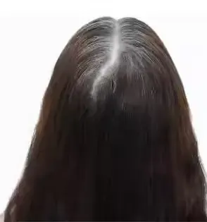 شعر أبيض وفضي قبل استخدام شامبو صبغة الشعر بالكافيار